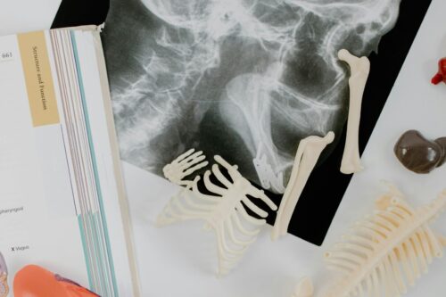 Materiali da studio anatomico: modello scheletrico coste, lastra X-ray e libro usati nell'approccio articolare.